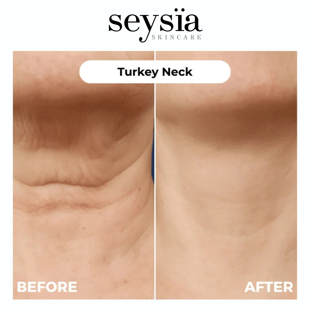 Seysïa – Collagen Renewal Anti-Aging Skincare