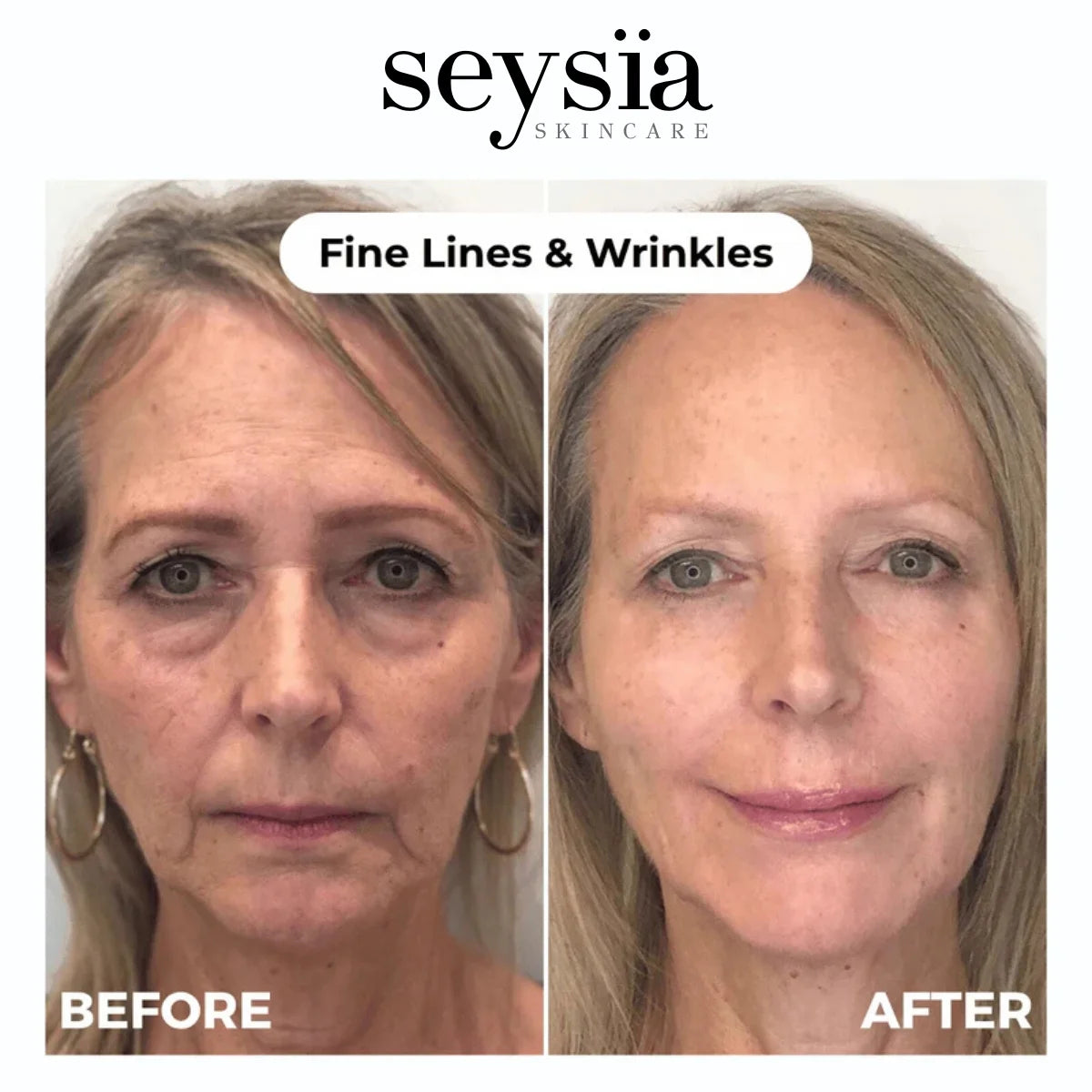 Seysïa – Collagen Renewal Anti-Aging Skincare