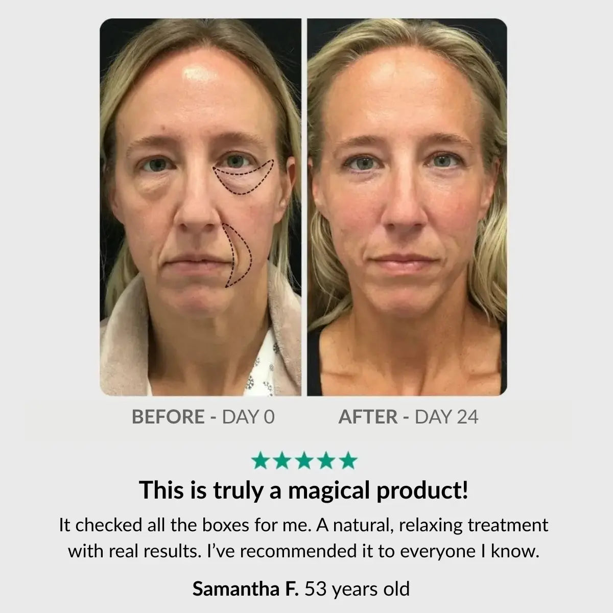 Complete Dark Circle Ritual: Pen & Activator Serum