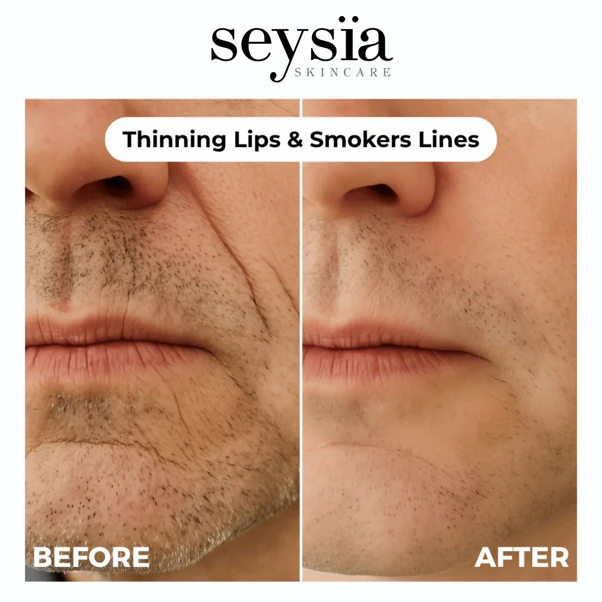 Seysïa – Collagen Renewal Anti-Aging Skincare
